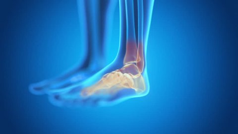 x-ray style - medical 3d animation of a male having acute pain in the ankle