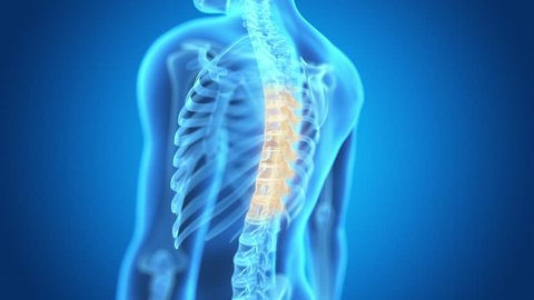 x-ray style - medical 3d animation of a male having acute pain in the mid back