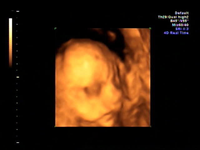 Baby ultrasound 4d scan