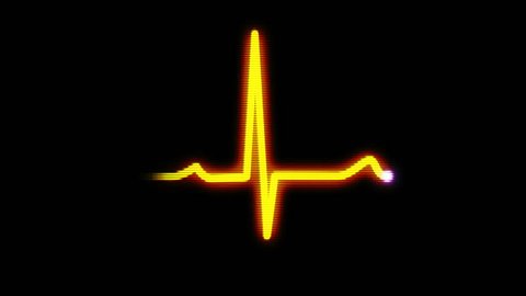 An animated 8-bit representation of a heart monitor EKG flatlines.  With sound and luma matte.