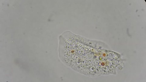 unicellular amoeba motion under microscope 600x