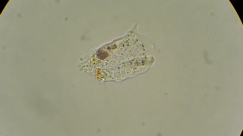 unicellular amoeba motion under microscope 600x