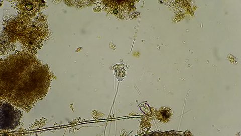 live unicellular vorticella filtrating water under microscope 400x