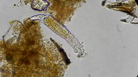 live microscopic animal rotifer feeding under microscope 400x