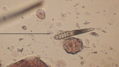 Demodectic Mange, Demodex (Demodex canis) seen under microscope at 80 times magnification after doing a skin scrape.