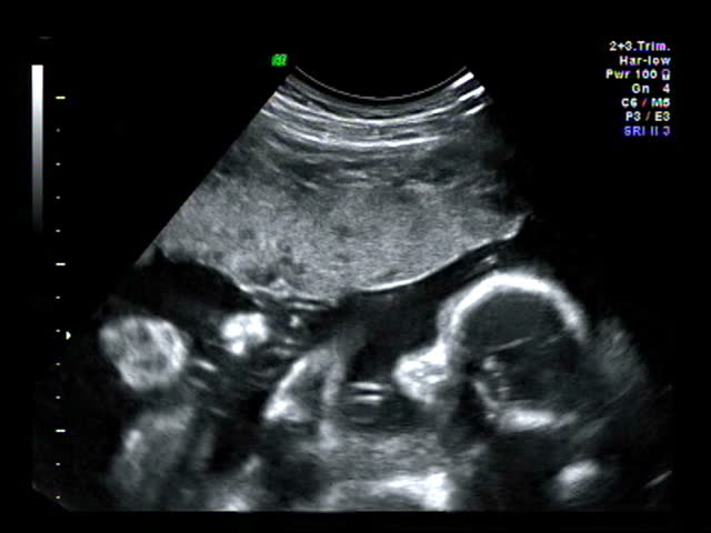 Baby ultrasound silhouette 4d scan