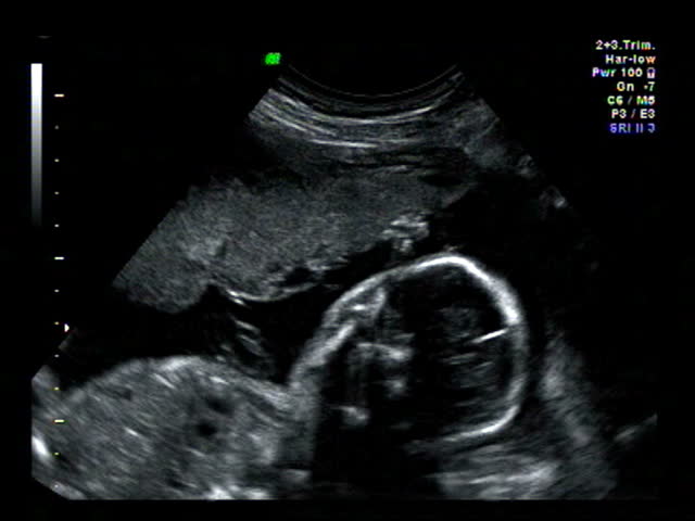 Baby ultrasound silhouette spine