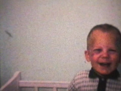 A cute little boy displays his black eye from a recent mishap. (1963 - Vintage 8mm film)