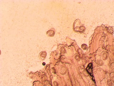Parasitic worm Trichinella spiralis (Trichinosis) in a sample of raw meat (muscle fibers) under microscopic larvae increase from damaged capsules twists and stir in the liquid.