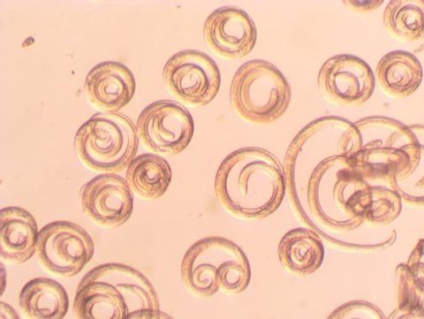 Parasitic worm Trichinella spiralis in a sample of raw meat after digestion of muscle fibers under microscopic larvae increase twists and stir in the liquid.
