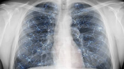 Chest x-ray - nervous system. Animation of breathing chest and artificial nervous system.
