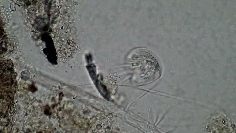 The tiny Aspidisca protozoan scurries around on wee cirri feet exploring its home and hunting for bits of food until shoved out of the path of a much larger bully Frontonia.