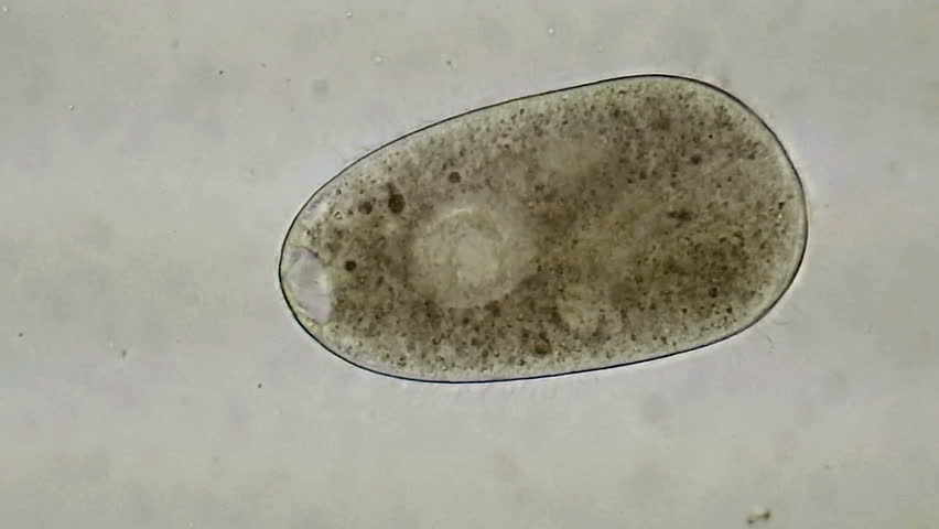 frontonia protozoan barrels through drop pond Stock Footage Video (100% ...