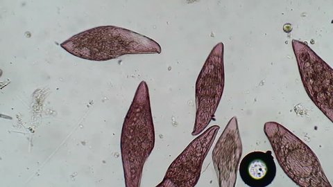 Pink Blepharisma protozoa bustle about in a drop of pond water.  Blepharisma is one of only two truly colored (achlorophyllic) common protozoa, the other being the blue Stentor. 
