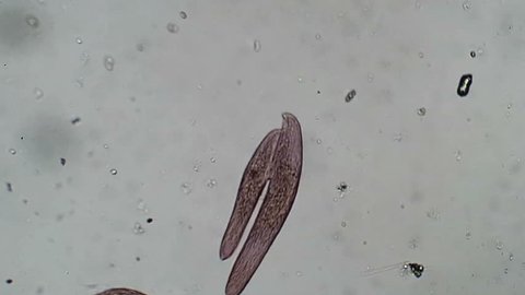 Pink Blepharisma protozoa in sexual conjunction.  While actual population increase is achieved by cell division, actual sexual recombination and nuclear exchange  is done in conjunction as shown here