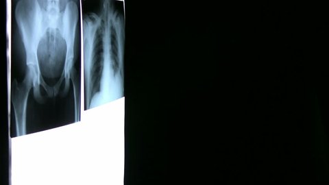 Doctor reviews Xrays that are hanging