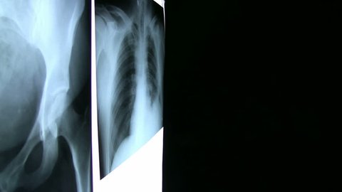 Surgeon reviews Xrays that are hanging