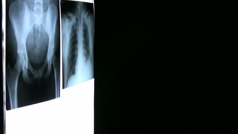 Man reviews Xrays that are hanging