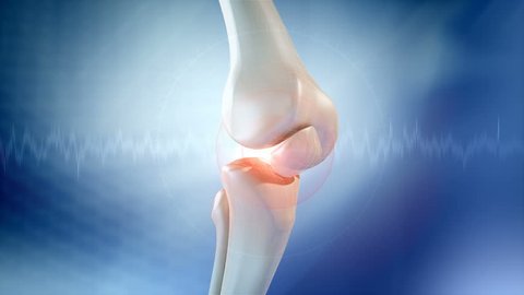Knee pain animation. Three High Quality animations of Knee pain.