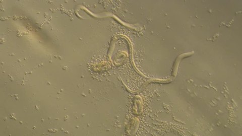 Caenorhabditis elegans, a free-living transparent nematode (roundworm), about 1 mm in length.