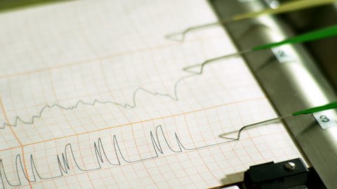The pens of a polygraph machine record on a printout the results of a deception detection test.