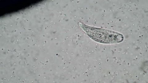 Spathidium feeding on motile spirilla bacteria. A good view of the mouth structure of this protozoan and the swimming manner of the of bacteria on which it is feeding.  Magnification 400x

