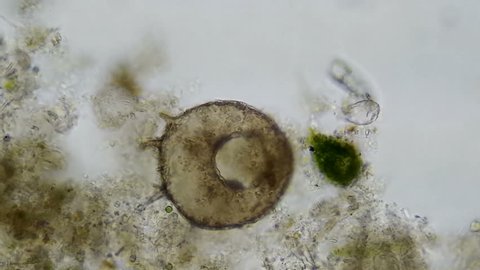 The clip starts with an empty ameba shell (Centropyxis sp.) The microscopic metazoan Gastrotrich gets its head stuck in the amoeba shell looking for food and gets stuck. Eventually, the shell thins.