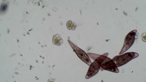 This is  a mixed culture of  the pink ciliate Blepharisma and the smaller fast-moving Urocentrum. Two of the Urocentrum are in rare conjugation (involved in the sexual exchange of nuclear material.) 