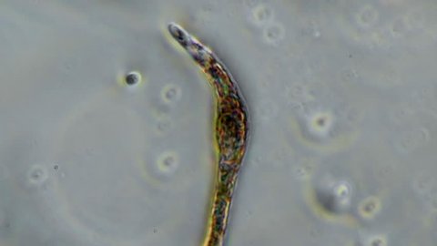 Nematode Worm Stretches Body While Swimming Under Microscope 400x