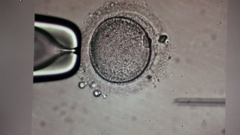 Field view of sperm cell injection in ovum through lab microscope