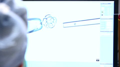 Closeup of fertilized ovum retrieval procedure through lab monitor