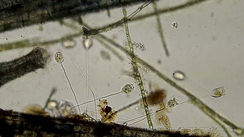 The Vorticella, as a group, use contractile stalks to attach themselves to stable surfaces but occasionally contracting rapidly to unknown stimuli. Here a family is shown happily feeding at 100x. 