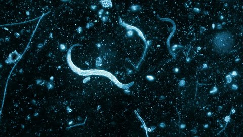 Three Nematode Worms Seen In Dark Field Microscope With Blue Filter 200x