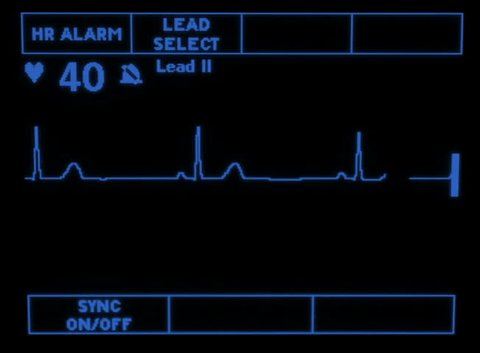 A Simulated Monitor Showing The Stock Footage Video 100 Royalty Free Shutterstock A Simulated Monitor Showing The Stock Footage Video 100 Royalty Free Shutterstock