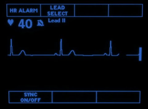 A Simulated Monitor Showing The Stock Footage Video 100 Royalty Free Shutterstock