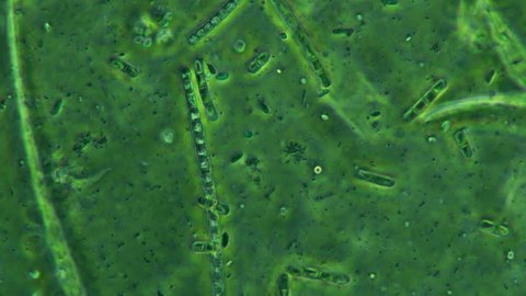 Bacteria Colony On Moss Plants Seen Feeding And Swimming with Protozoa 