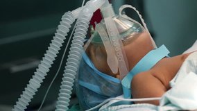 unidentified child with oxygen mask ready for surgery