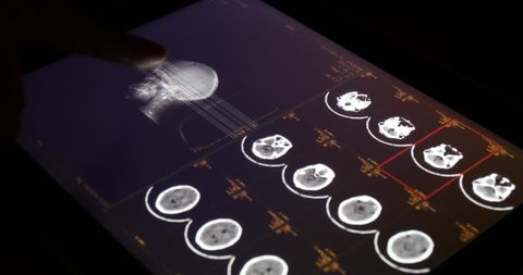 4k Doctor Operating PET-CT X-ray film on touchscreen ipad app software for analysis.scientific radiography hightech radiation background,orthopaedic organs.health medical hospital. gh2_08327_4k