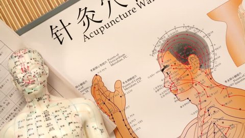 Chinese Medicine - Acupuncture is a system of complementary medicine in which fine needles are inserted in the skin at specific points along what are considered to be lines of energy (meridians) - HD
