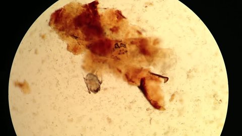 ear mite (Otodectes) under microscope