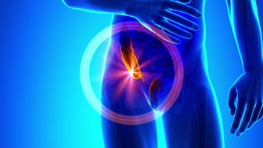 Appendix Pain Anatomy Stock Footage Video (100% Royalty-free) 7159873 | Shutterstock