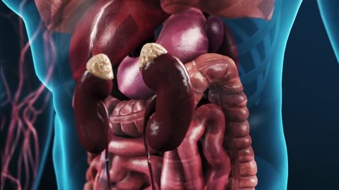 Zoom in from outside the body to the kidney showing diseased glomeruli and blood flowing through the afferent and efferent arterioles