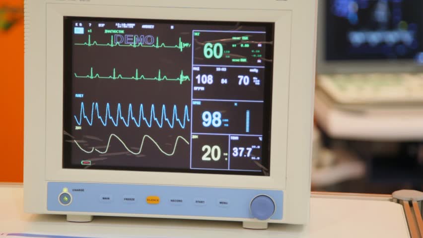 Micro monitor. Частота обновления экрана 120гц. Frequency монитор. Monitor frequency. Frequency monitoring syst втз прибор.
