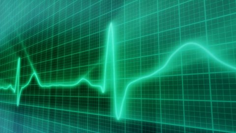 loopable background EKG electrocardiogram pulse real waveform