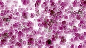 animation of purple cells and virus 