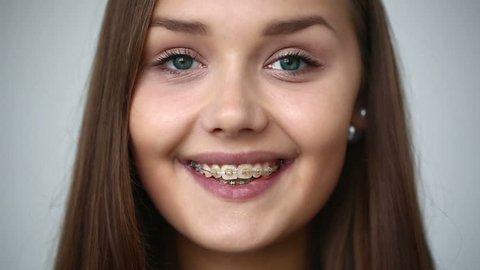 SLOW MOTION: Young girl with braces on teeth looking at camera and smiling. 