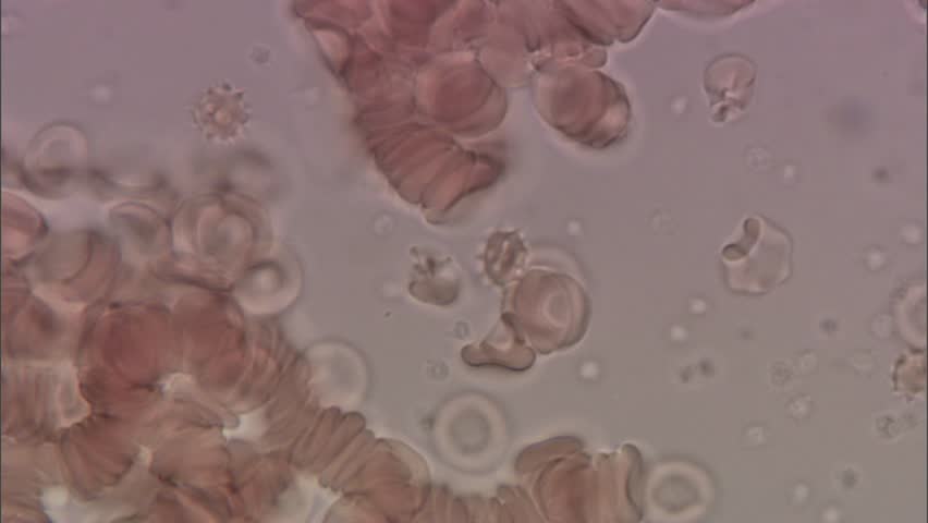 Mosquito plamodium as seen through a microscope. | Shutterstock HD Video #7753465