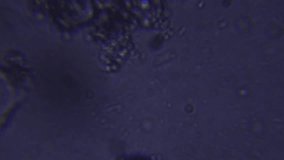 A single drop of water from the lake at my workplace teems with multiple species of microscopic life. This video focuses on a large protozoan and his activity.

