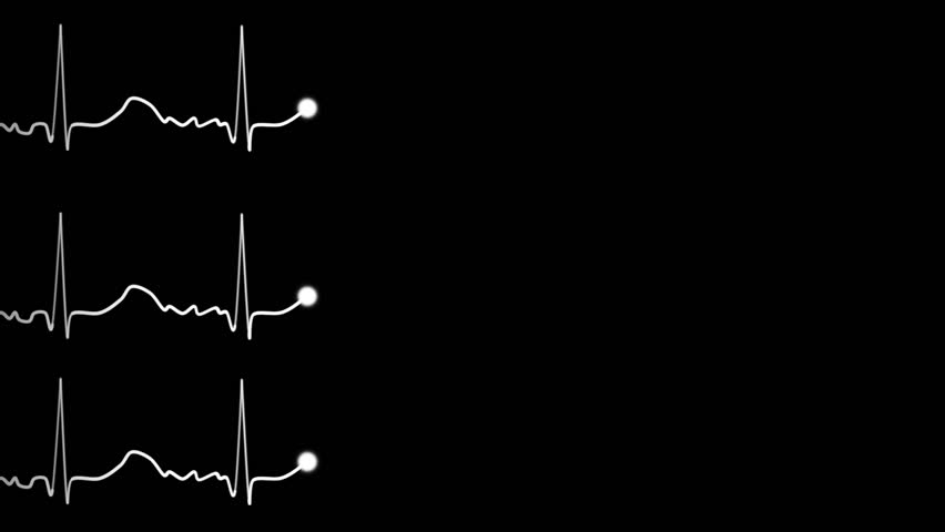 Three EKG/ECG traces.  With luma matte and sound effects.