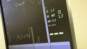 Compilation of several videos of Heart rate monitors in surgery room and emergency room showing heartbeat from different positions and several patients beds.